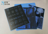 Фильм медицинского отображения низкого ЛЮБИМЦА тумана голубого струйный 8 x 10 дюймов для принтера Epson