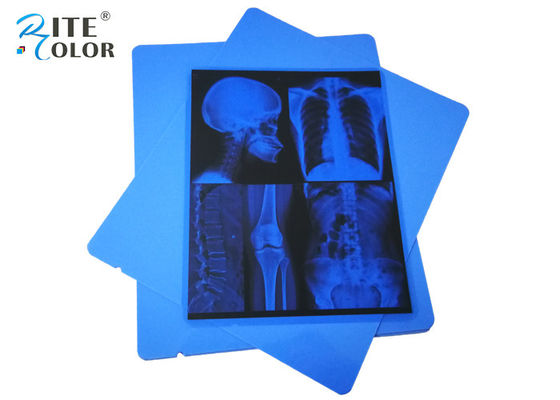 Радиология рентгеновского снимка ЛЮБИМЦА фильма медицинского отображения 13 x 17 дюймов голубая струйная